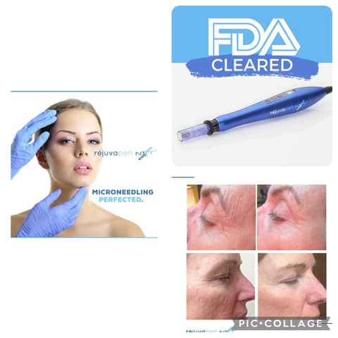 Rejuvapen NXT microneedling system, the device used at Esthetics By Terry